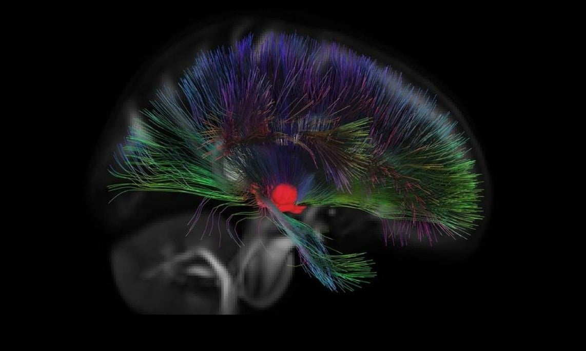Precision Therapeutics for Schizophrenia Symposium